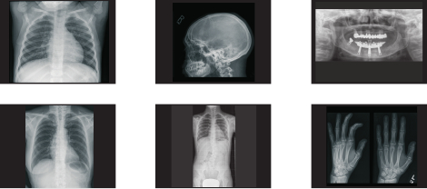 Снимки, сделанные дигитайзером AGFA DXG