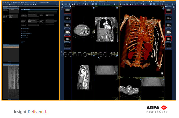 IMPAX Agility: Рабочий стол проведения диагностики