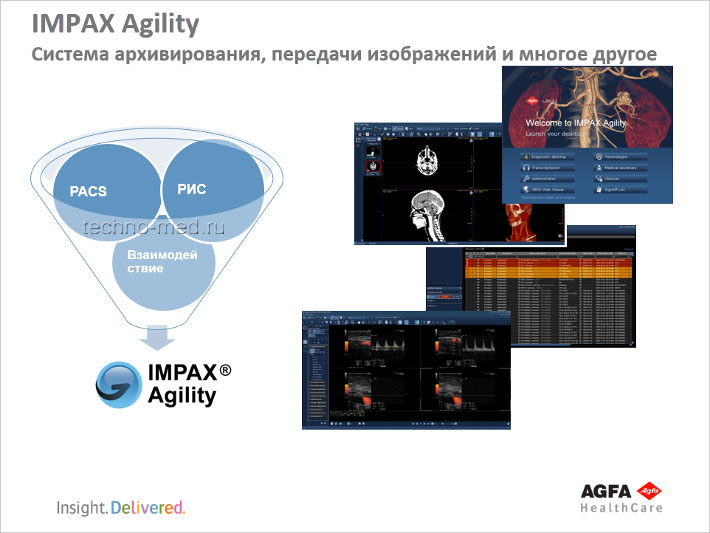 AGFA IMPAX Agility - Система архивирования, передачи изображений и многое другое