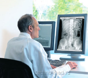 Автоматизированное рабочее место врача AGFA SE Suite