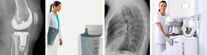 Взаимодействие специалиста-рентгенолога с дигитайзером AGFA